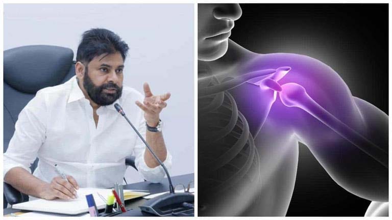 రొటేటర్ కఫ్ ఇంజురీ భుజం నొప్పి లక్షణాలు చికిత్స